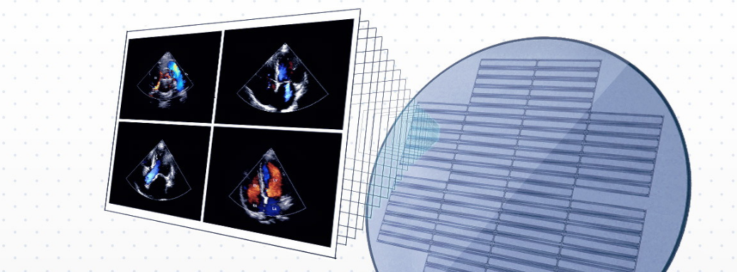 ultrasound transducers