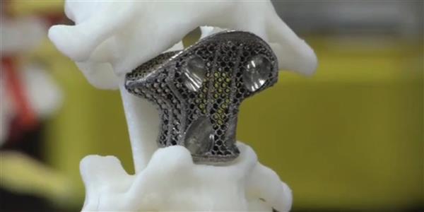 3D Printed Medical Devices