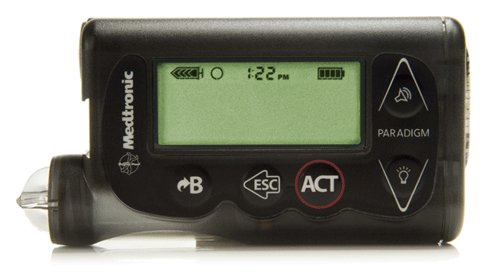 FDA says Medtronic MiniMed insulin pump recall is serious - MassDevice