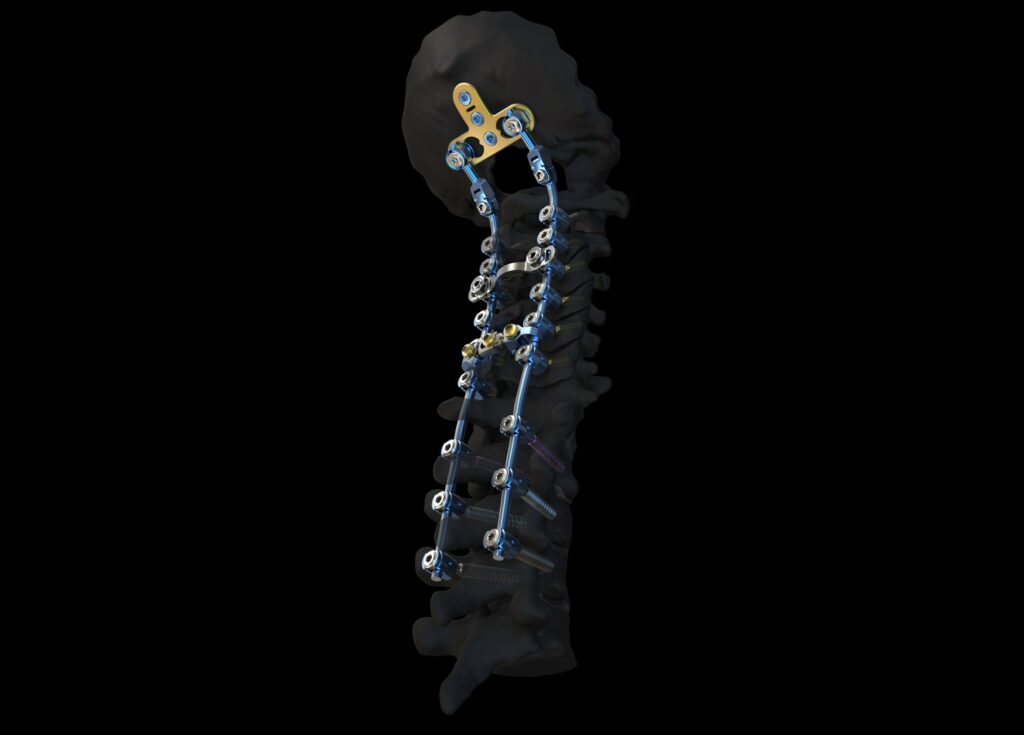 DePuy Synthes FINAL Symphony Image