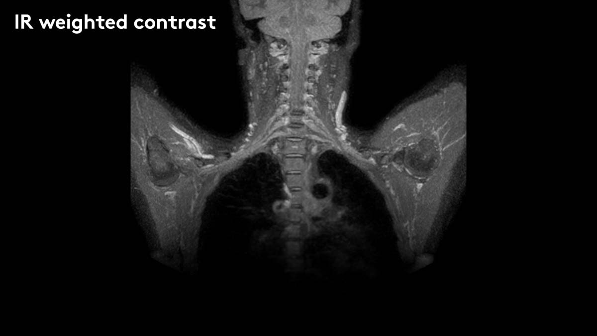 ir-weighted-contrast