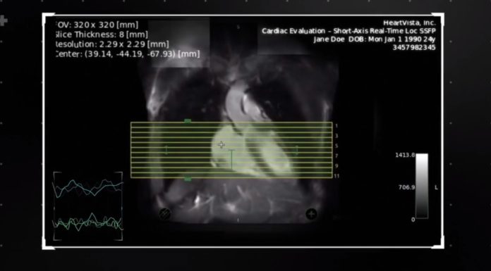 heartvista_oneclickmri-696x385