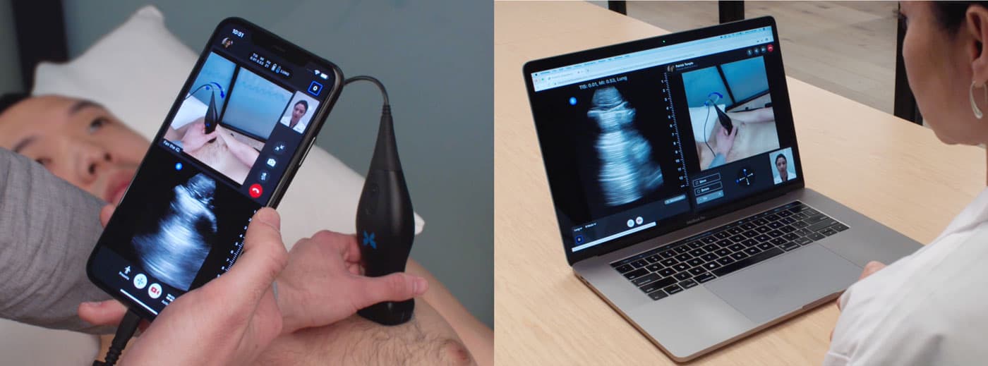 Butterfly Network Ultrasound Telemedicine