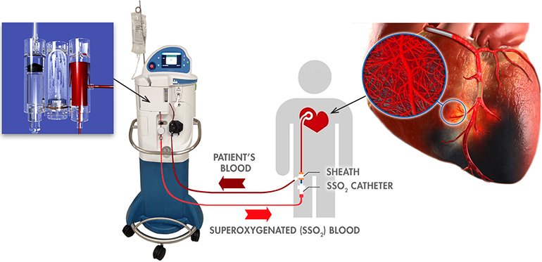 Oxygen Therapy Device