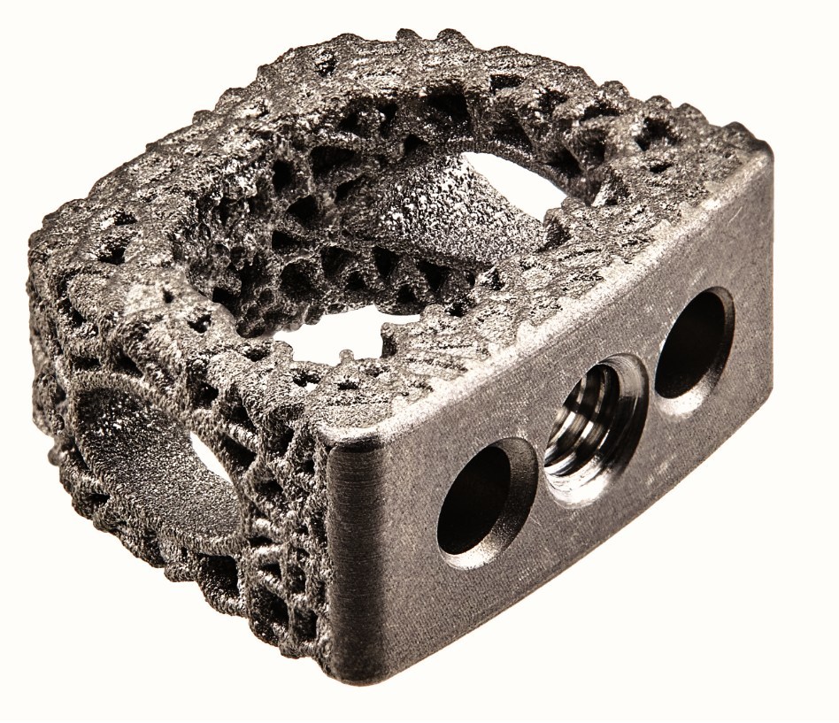 Flux-C 3D printed porous titanium cervical interbody
